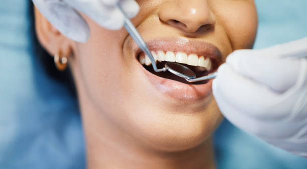 Best Chipped Tooth Repair Near Me  in Wood Dale, IL